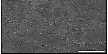 Un r&eacute;seau d'empreintes de champignons &agrave; la surface d'une muscovite apr&egrave;s incubation de 12 semaines avec Aspergillus niger.